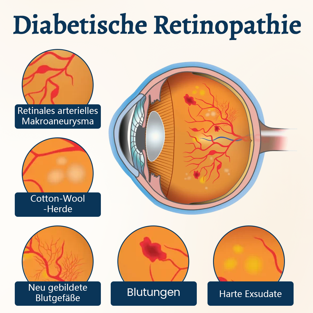 Ceoerty® OptiFusion Vision Support Augenpflaster👁️✨