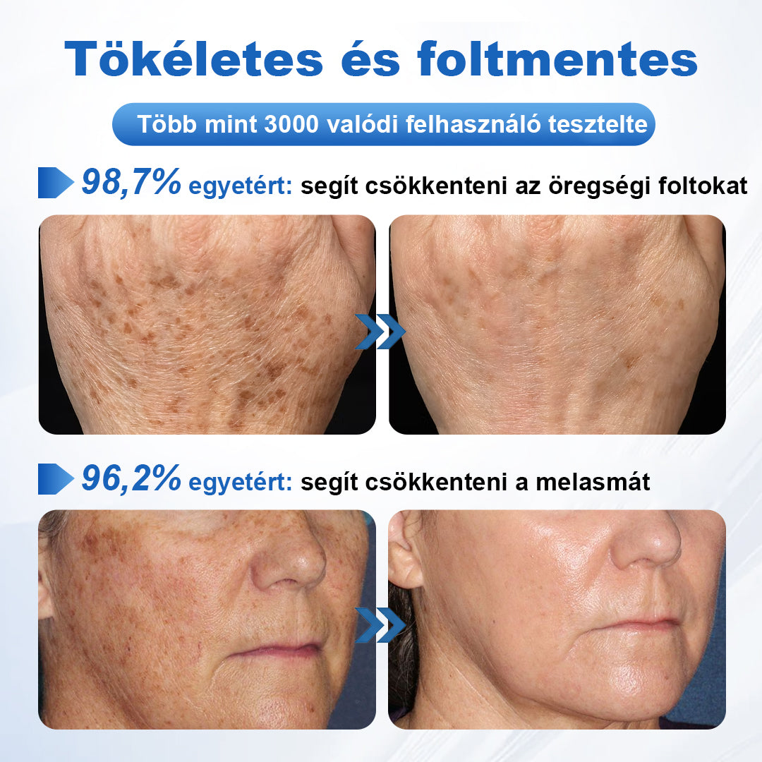 🛡️CleraNaure® GlowFade – Fényhozó és Folthalványító Arcmaszk
