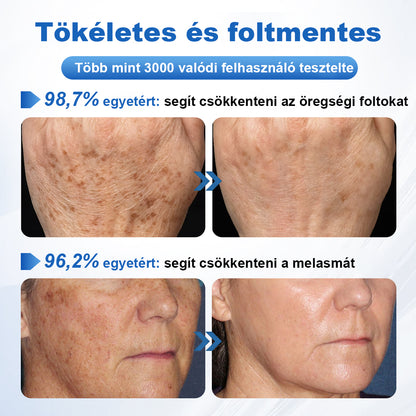 🛡️CleraNaure® GlowFade – Fényhozó és Folthalványító Arcmaszk