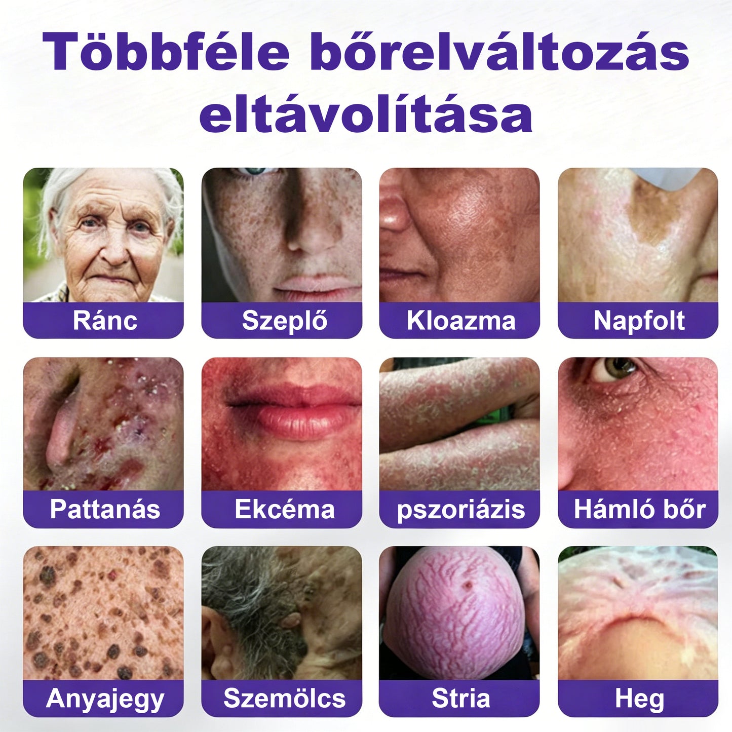 🛡️CleraNaure® mikrotűs szemölcs- és anyajegyeltávolító tapasz
