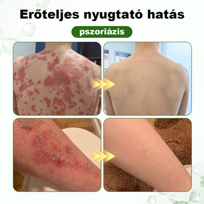 CleraNaure® DermaOat Növényi Védőréteg-krém
