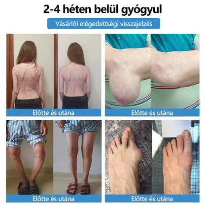 ClearaNature® Nano-tűs közös tapasz