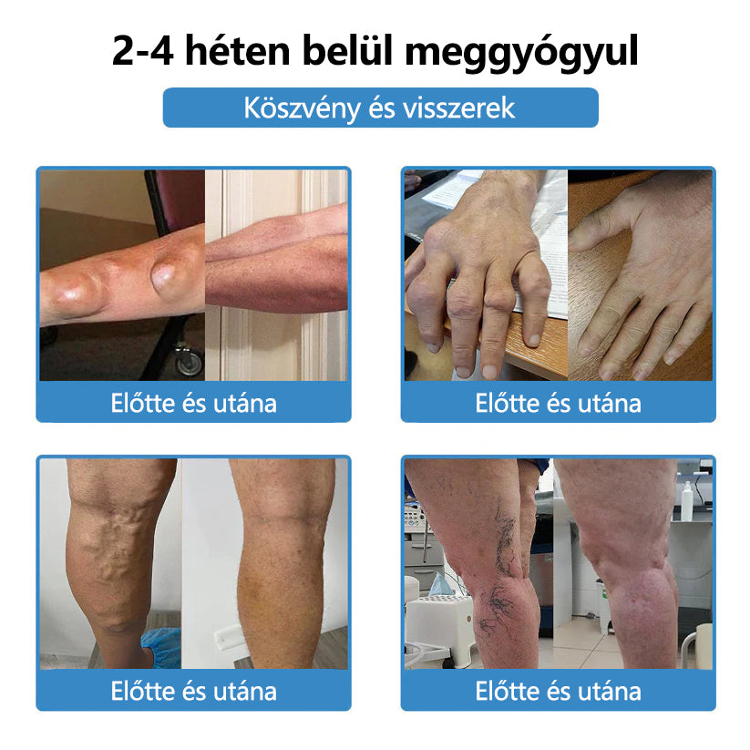 ClearaNature® Nano-tűs közös tapasz