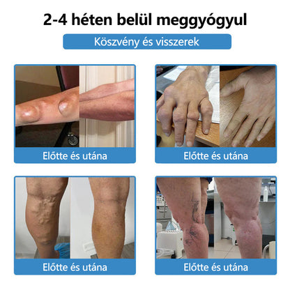 ClearaNature® Nano-tűs közös tapasz