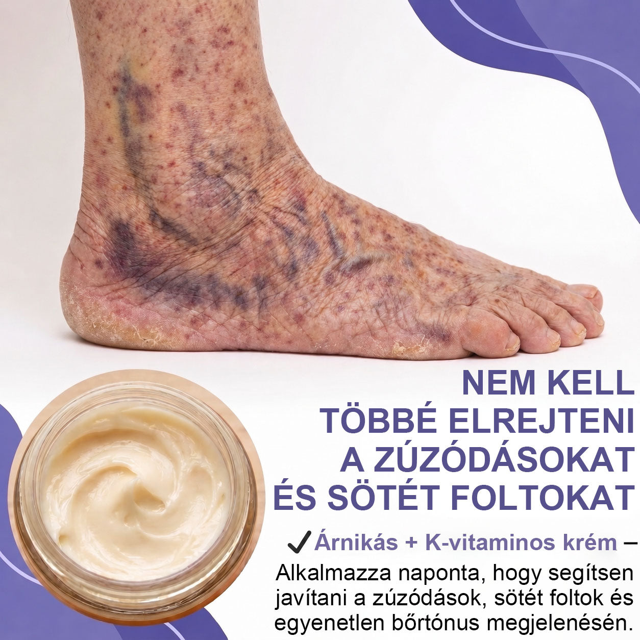 100K+ ELADOTT PÉLDÁNY 🔥 CleraNaure® Sötétfolt- és Zúzódásregeneráló Krém