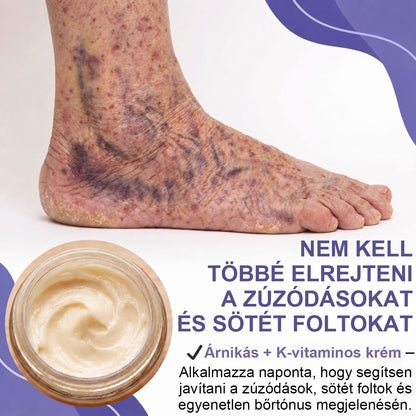 100K+ ELADOTT PÉLDÁNY 🔥 CleraNaure® Sötétfolt- és Zúzódásregeneráló Krém