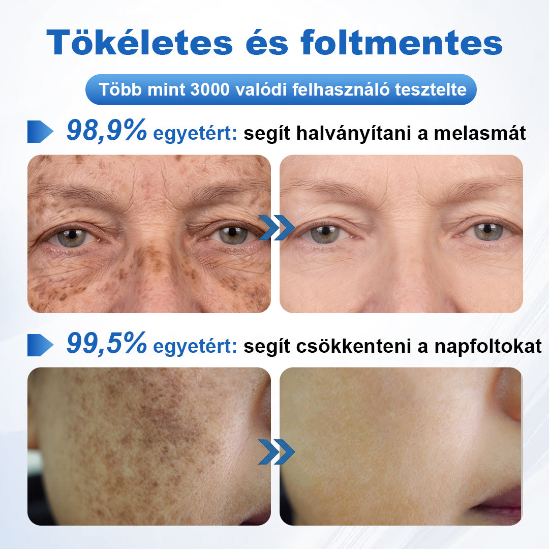 🛡️CleraNaure® GlowFade – Fényhozó és Folthalványító Arcmaszk