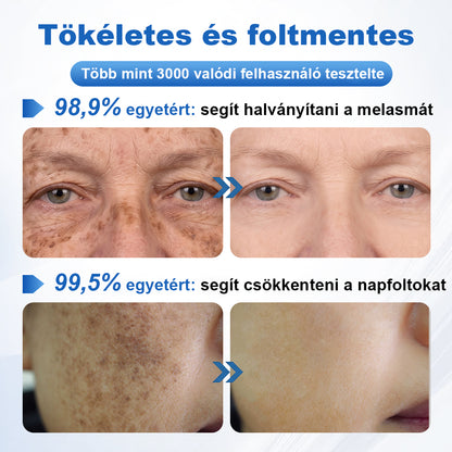 🛡️CleraNaure® GlowFade – Fényhozó és Folthalványító Arcmaszk