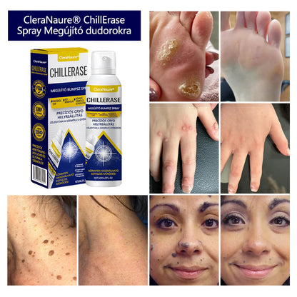 🛡️CleraNaure® ChillErase dudorjavító spray