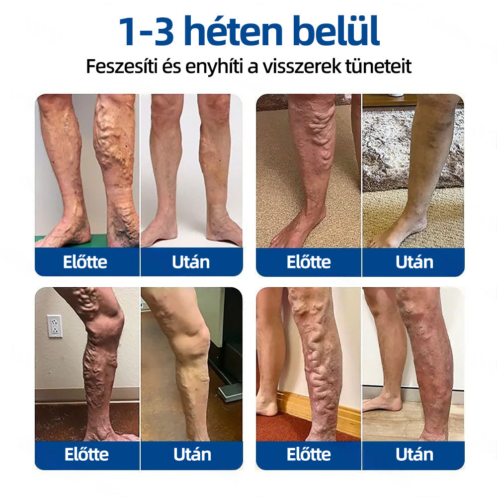 ✨𝐇𝐞𝐚𝐥𝐫𝐢𝐳𝐞®VeinTarget mikrotűs tapasz