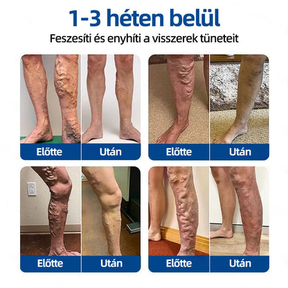 ✨𝐇𝐞𝐚𝐥𝐫𝐢𝐳𝐞®VeinTarget mikrotűs tapasz
