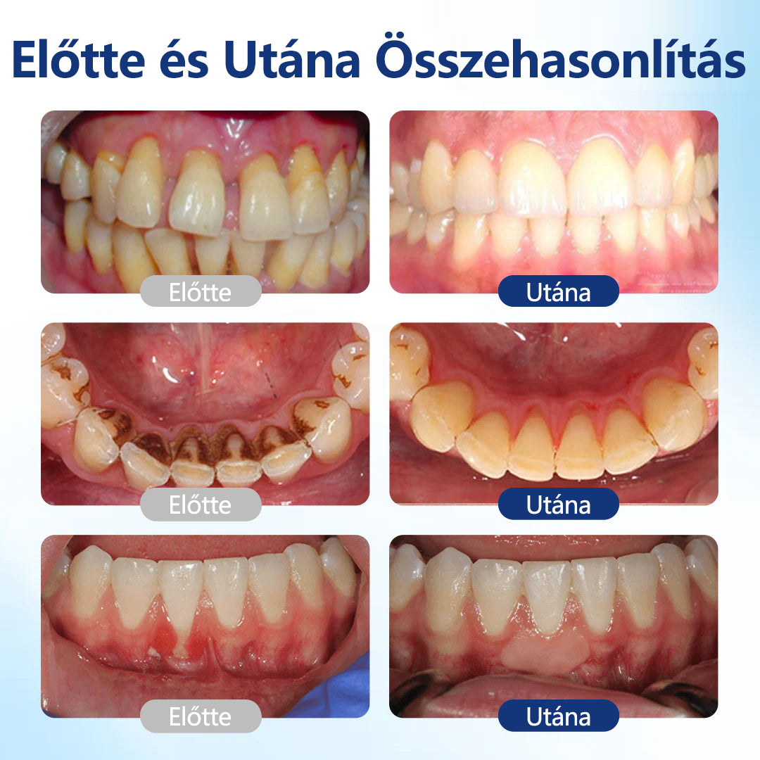CleraNaure® BeeTakt Szájápoló Javító Oldat