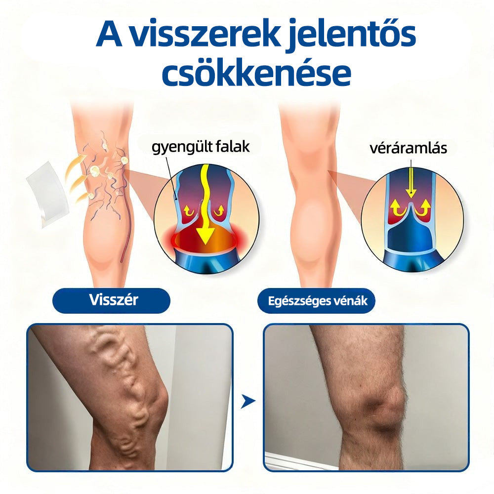 🇭🇺𝐇𝐞𝐚𝐥𝐫𝐢𝐳𝐞® 👩‍⚕️VeinTarget mikrotűs tapasz⚡☑️Azonnali enyhülés hosszú távú eredmények
