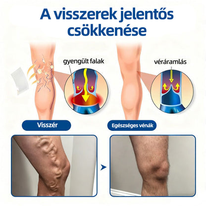 🇭🇺𝐇𝐞𝐚𝐥𝐫𝐢𝐳𝐞® 👩‍⚕️VeinTarget mikrotűs tapasz⚡☑️Azonnali enyhülés hosszú távú eredmények
