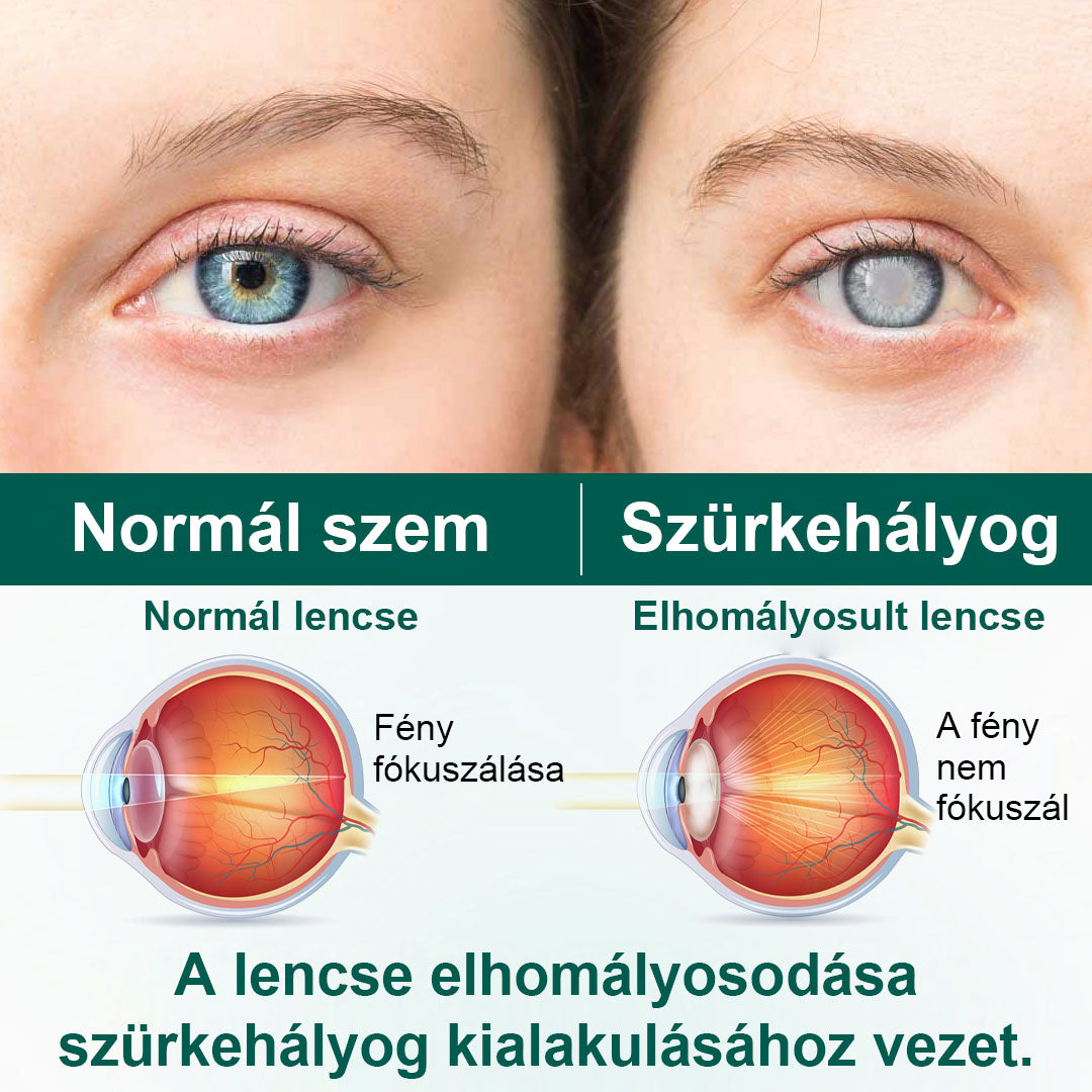 CleraNaure® OptiClear Nano Szemgörgő Szérum