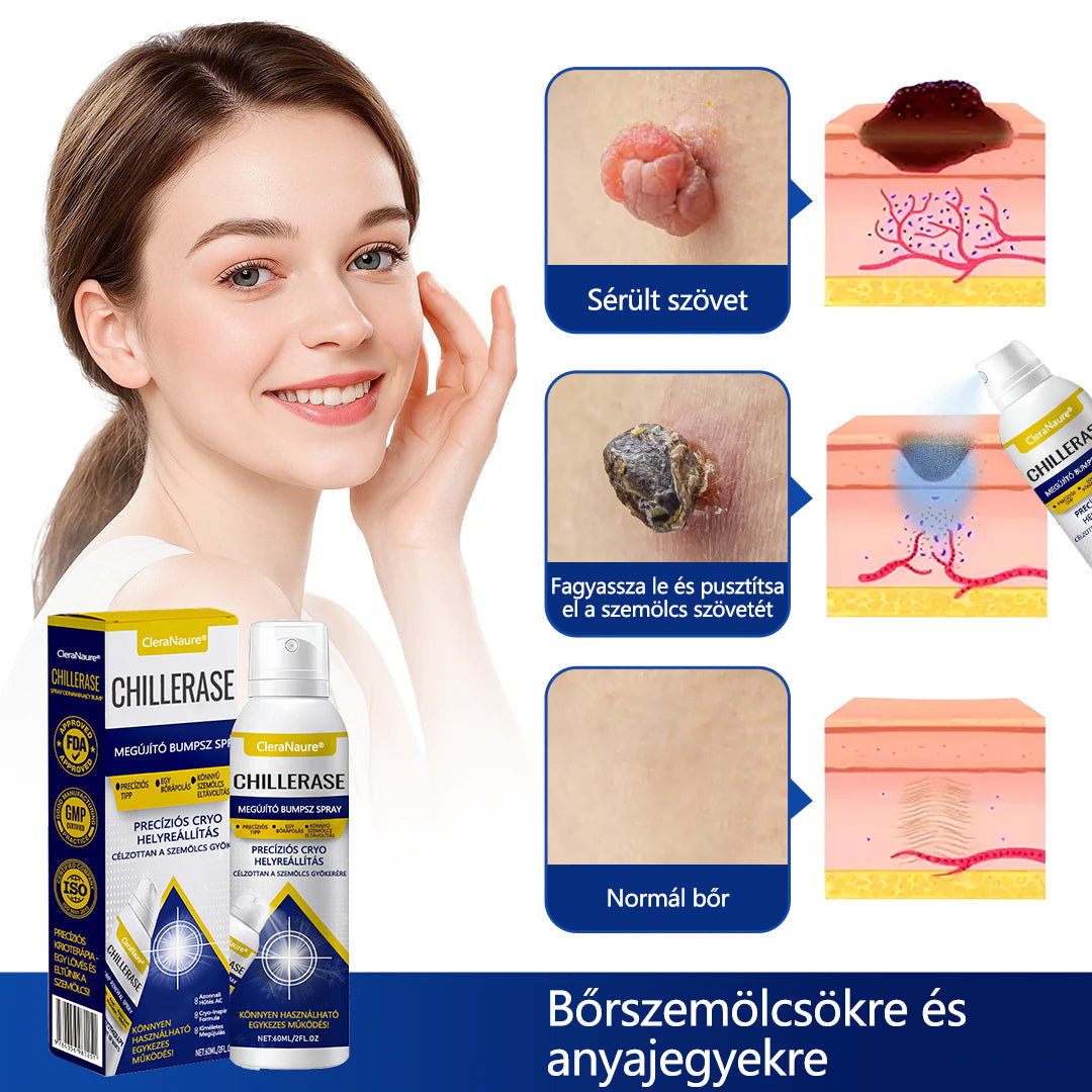 🛡️CleraNaure® ChillErase dudorjavító spray