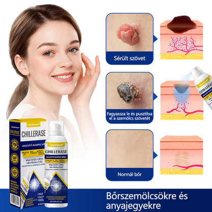 🛡️CleraNaure® ChillErase dudorjavító spray