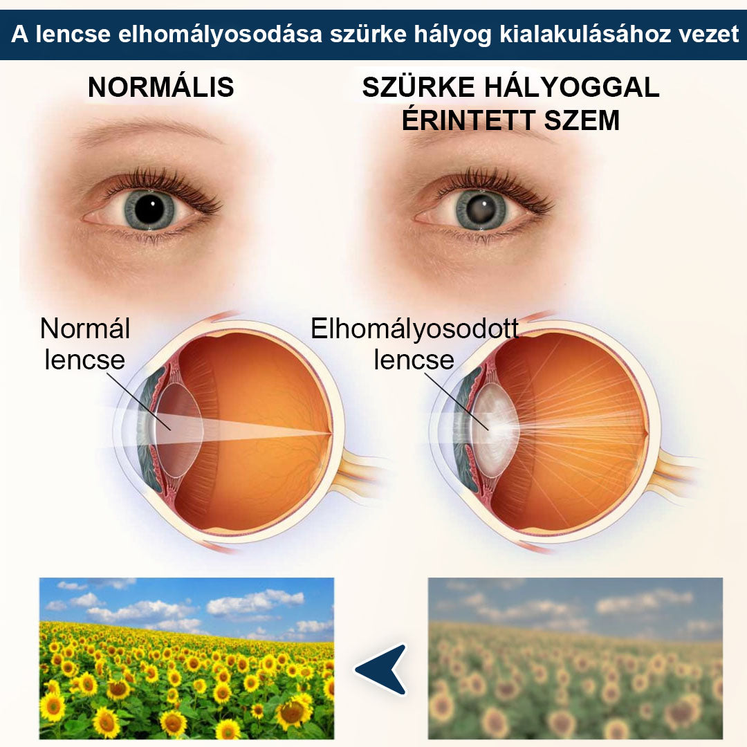 CleraNaure® OptiFusion Vision Support – Szemkörnyékápoló tapasz a látás támogatásáért 👁️✨