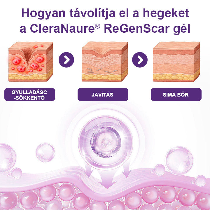 🥇CleraNaure® ReGenScar Őssejtes Hegkezelő Gél