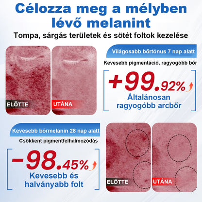 🛡️CleraNaure® GlowFade – Fényhozó és Folthalványító Arcmaszk