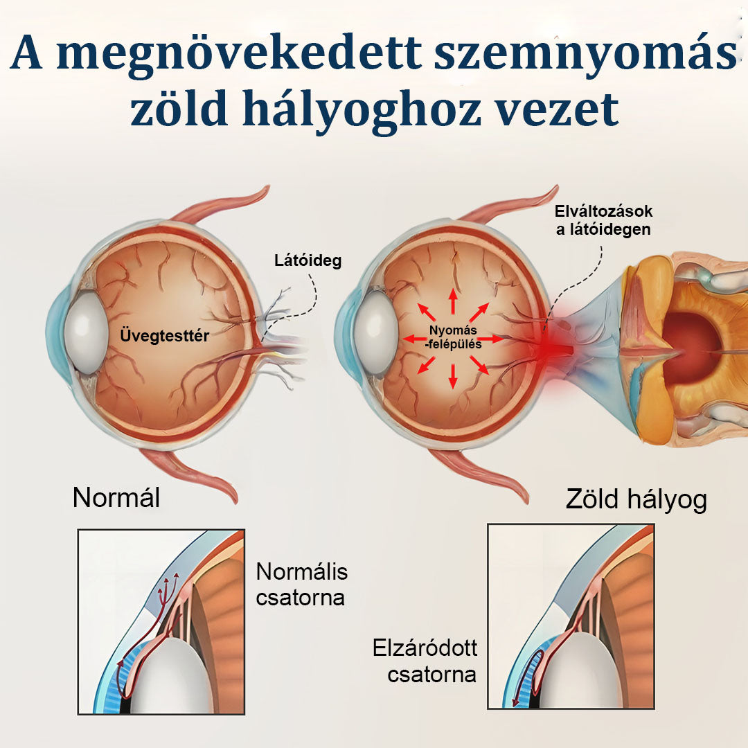 CleraNaure® OptiFusion Vision Support – Szemkörnyékápoló tapasz a látás támogatásáért 👁️✨