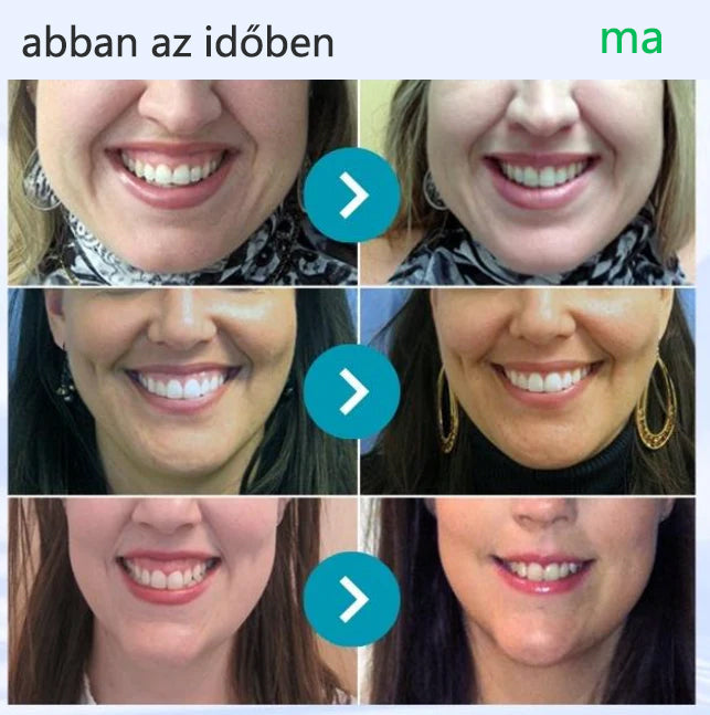 💎CleraNaure® VioCore Méregtartalmú Fogászati Kezelő Fogkrém