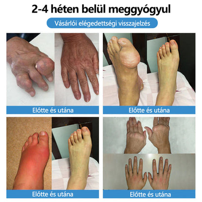 ClearaNature® Nano-tűs közös tapasz