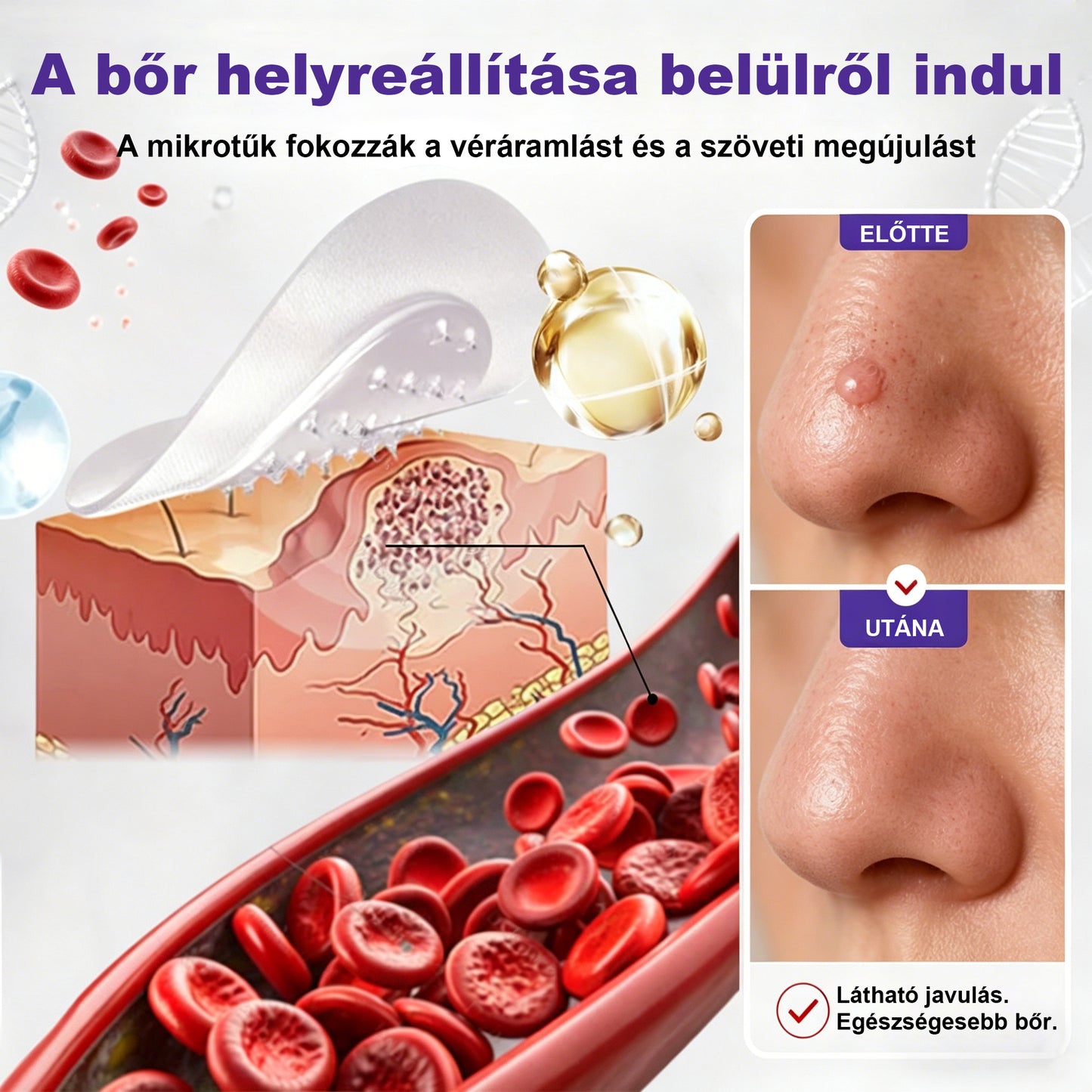 🛡️CleraNaure® mikrotűs szemölcs- és anyajegyeltávolító tapasz