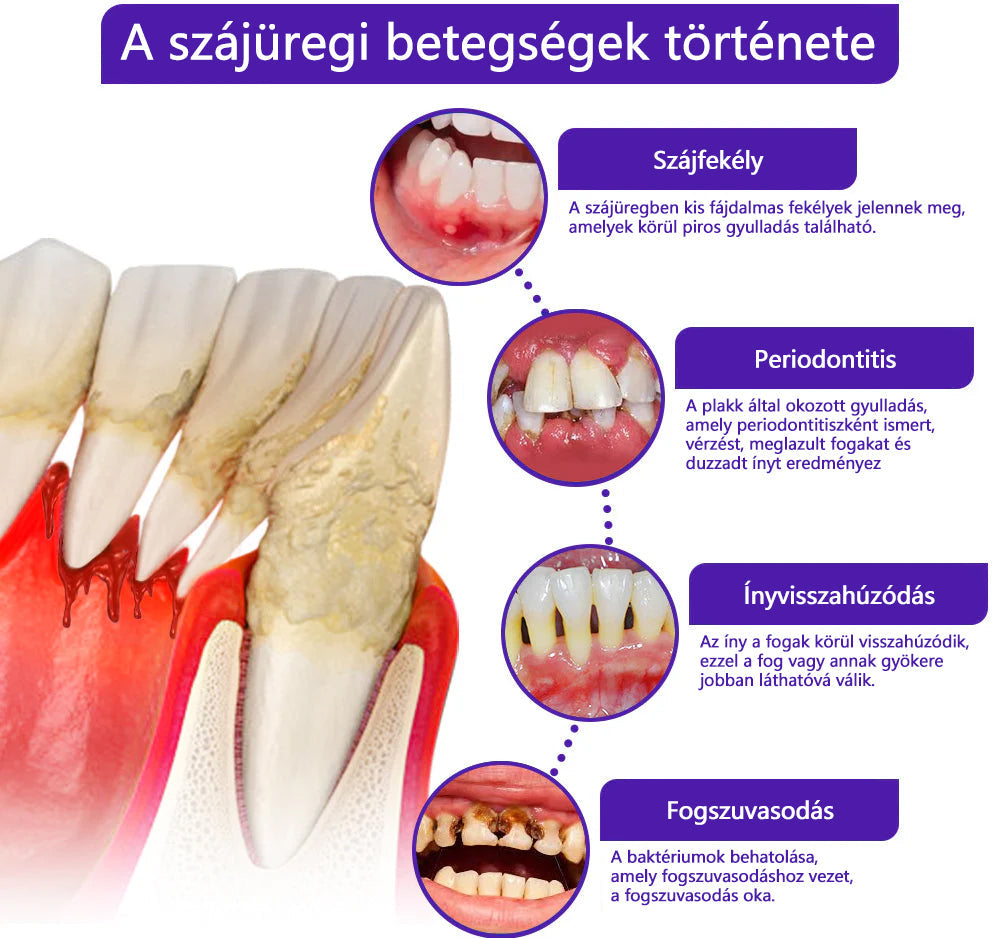💎CleraNaure® VioCore Méregtartalmú Fogászati Kezelő Fogkrém