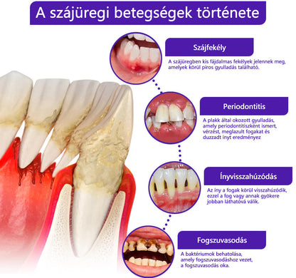 💎CleraNaure® VioCore Méregtartalmú Fogászati Kezelő Fogkrém