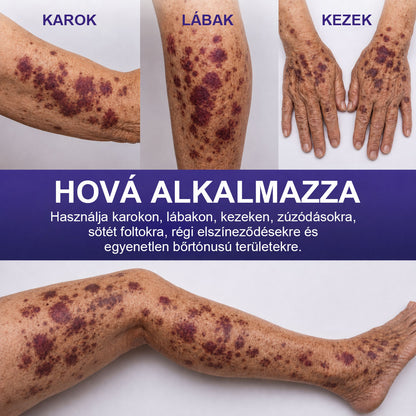 100K+ ELADOTT PÉLDÁNY 🔥 CleraNaure® Sötétfolt- és Zúzódásregeneráló Krém