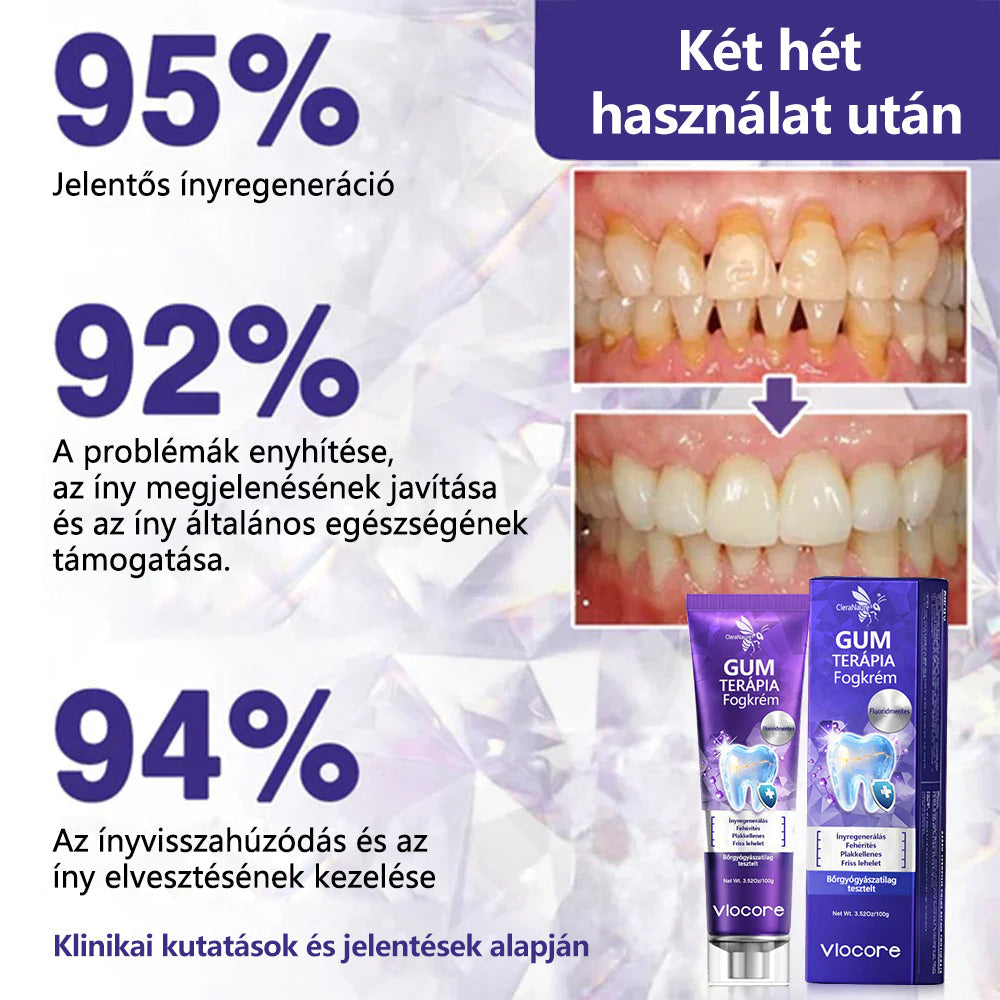 💎CleraNaure® VioCore Méregtartalmú Fogászati Kezelő Fogkrém