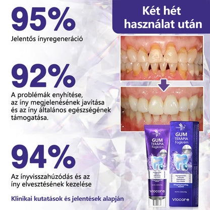 💎CleraNaure® VioCore Méregtartalmú Fogászati Kezelő Fogkrém
