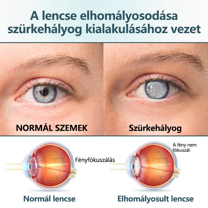 🥇CleraNaure® Optifusion Nano Szemcsepp Szérum-A nanotechnológia visszaállítja a tiszta látást, szemüveg nélkül, műtét nélkül