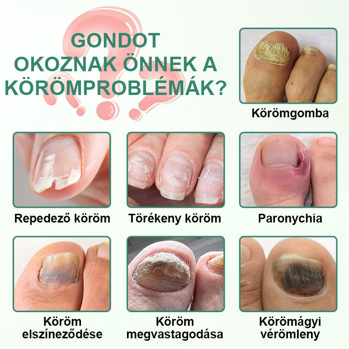 CleraNaure® Körömméregtelenítő Penetrációs Szérumtoll