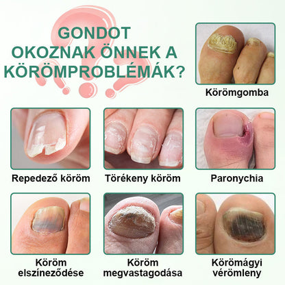 CleraNaure® Körömméregtelenítő Penetrációs Szérumtoll
