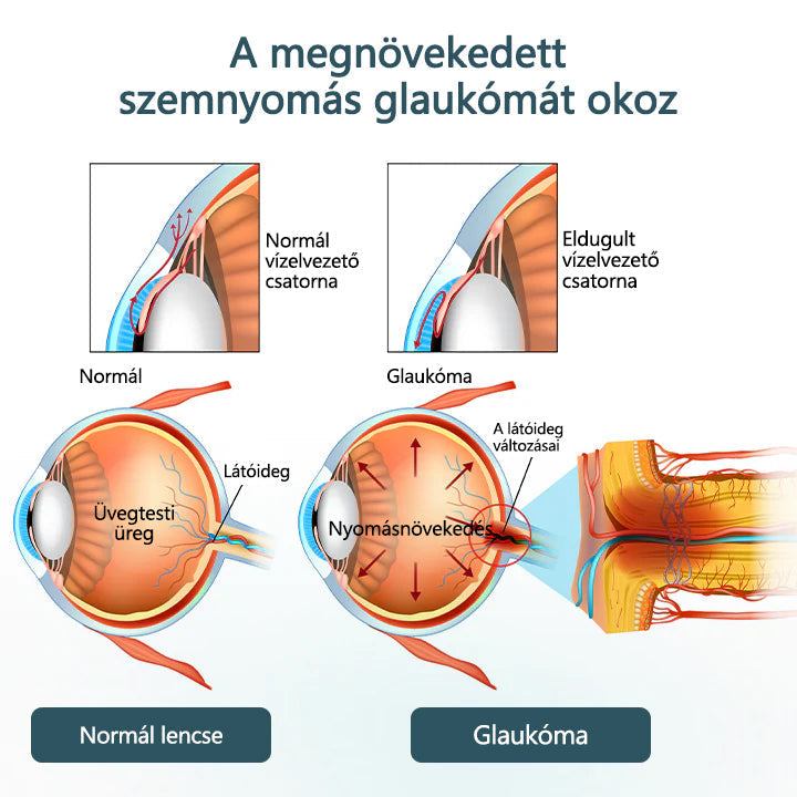 🥇CleraNaure® Optifusion Nano Szemcsepp Szérum-A nanotechnológia visszaállítja a tiszta látást, szemüveg nélkül, műtét nélkül