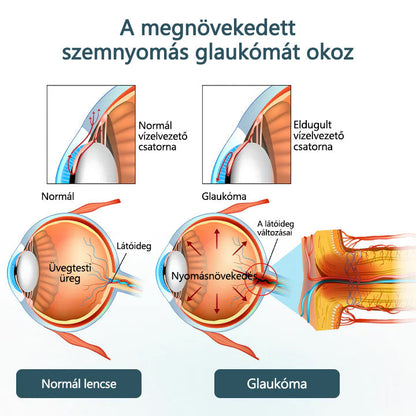 🥇CleraNaure® Optifusion Nano Szemcsepp Szérum-A nanotechnológia visszaállítja a tiszta látást, szemüveg nélkül, műtét nélkül