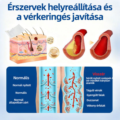 🇭🇺𝐇𝐞𝐚𝐥𝐫𝐢𝐳𝐞® 👩‍⚕️VeinTarget mikrotűs tapasz⚡☑️Azonnali enyhülés hosszú távú eredmények